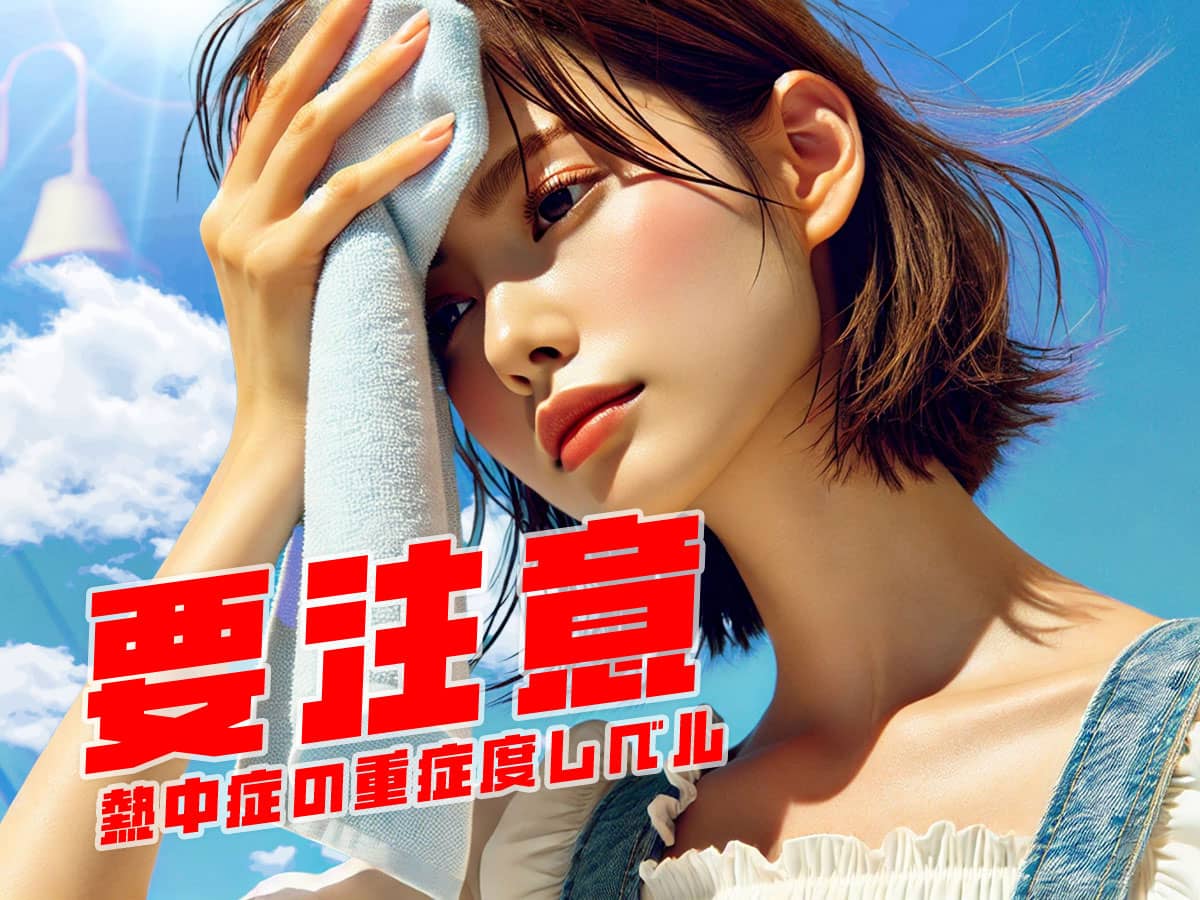 熱中症の重症度レベル